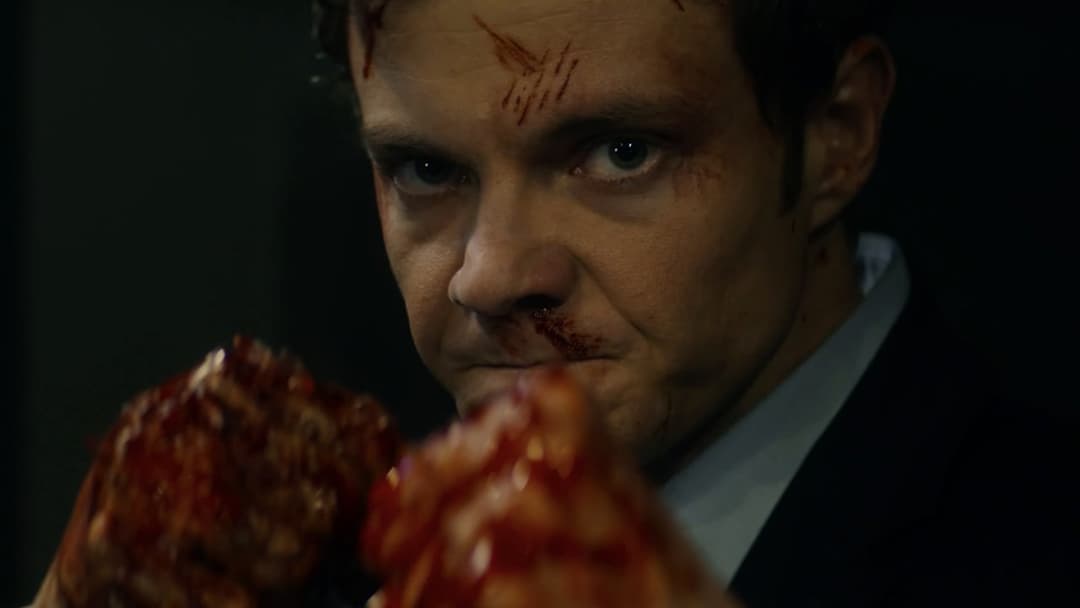 Новокаїн backdrop 5